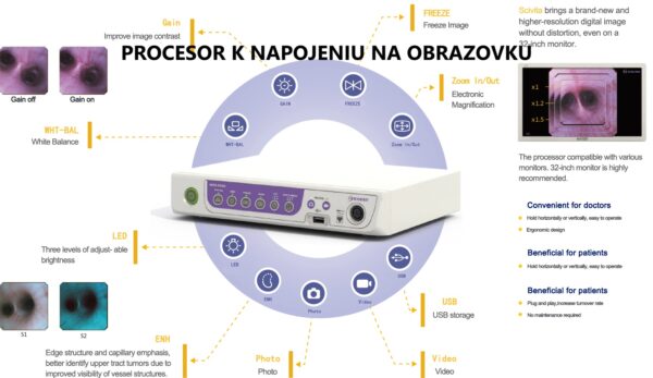 Procesor k cystoskopu