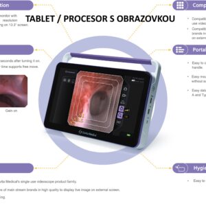 Tablet k cystoskopu