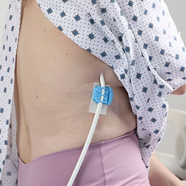 Univerzálny fixačný systém FlexGRIP na kanyly, cievky, drôty , 11-18 Fr